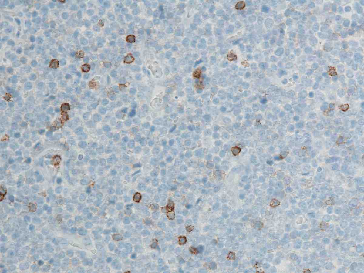 Lymph node 2010 CD8 40X
